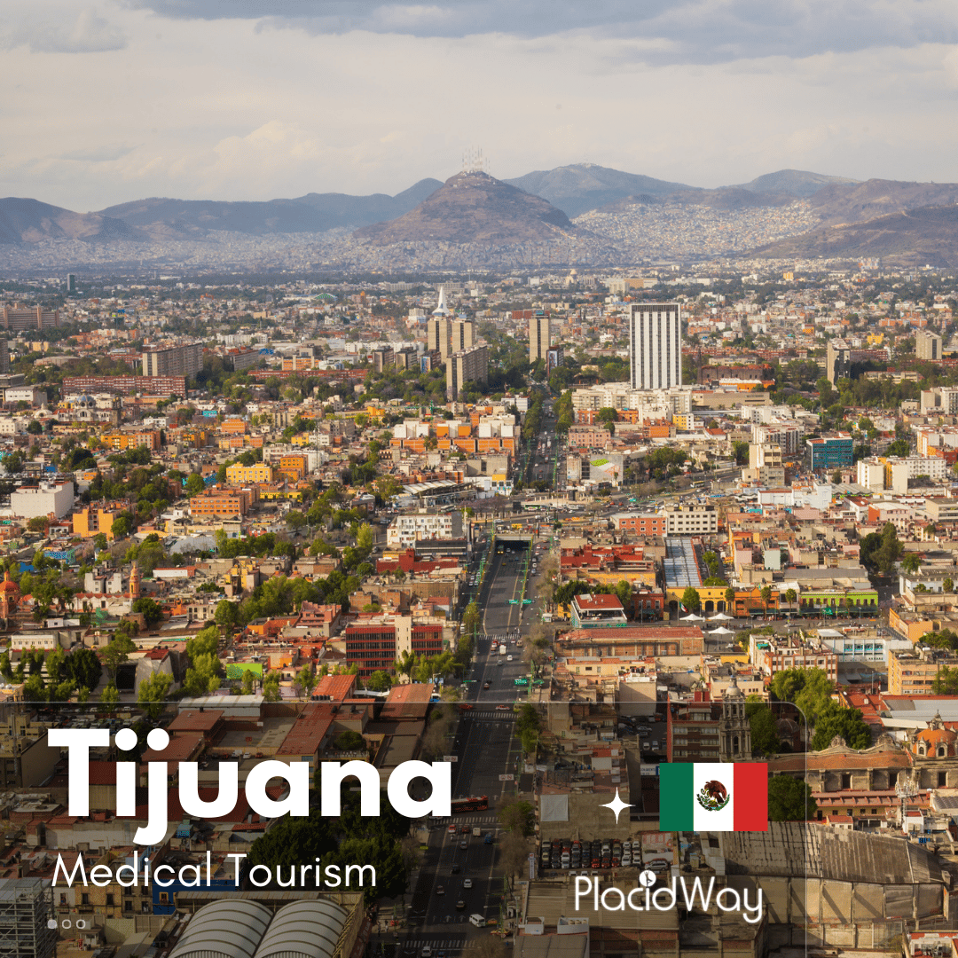 تيخوانا Medical Tourism